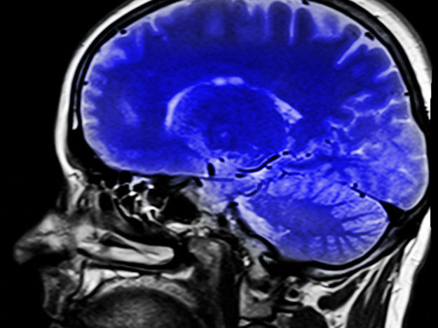 cerebro_inteligen_analytics.jpg
