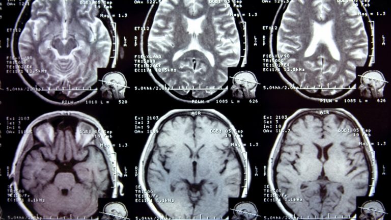 IA criada por brasileiros tomografia 1