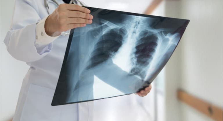 Com Google Cloud Portal Telemedicina utiliza IA para acelerar identificacao de Covid 19