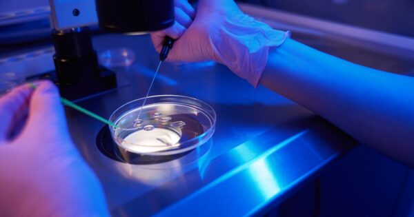 Imagem de um procedimento de reprodução assistida em laboratório, mostrando mãos com luvas manipulando uma placa de Petri sob luz azul. Um dos instrumentos está sendo usado para manipular ou injetar material genético em óvulos, representando um estágio de fertilização in vitro (FIV). A cena ocorre em ambiente estéril, com equipamentos laboratoriais visíveis ao fundo.